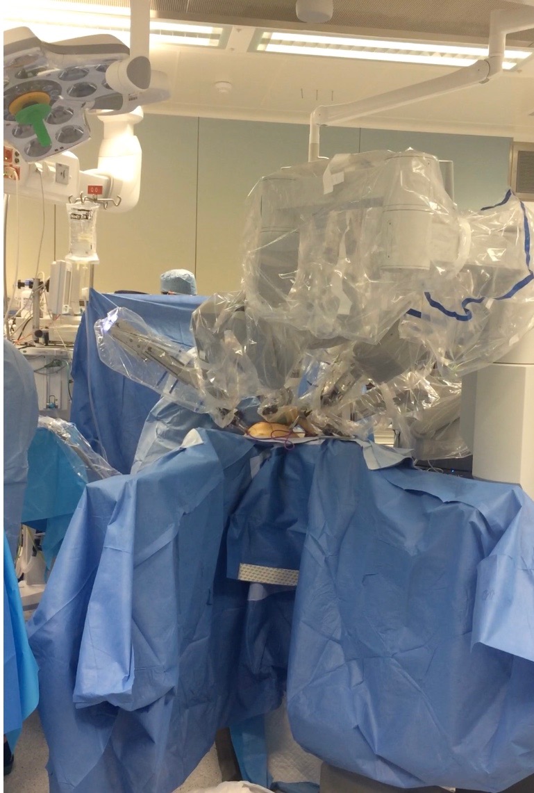 Robotic surgery procedure